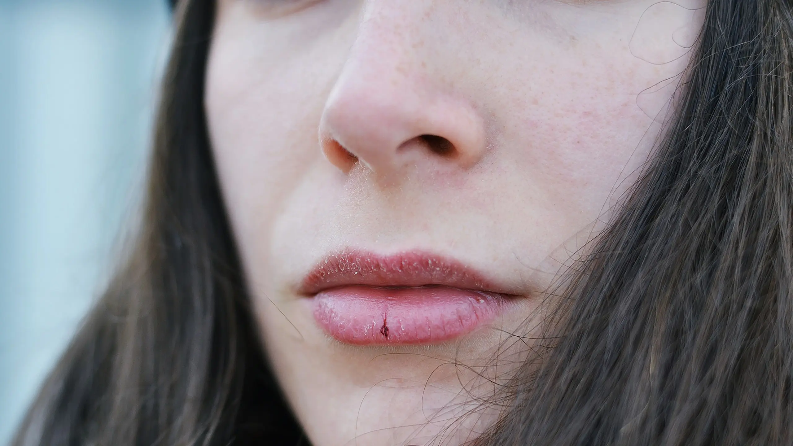 Как избежать потрескавшихся губ этой зимой, по словам дерматологов